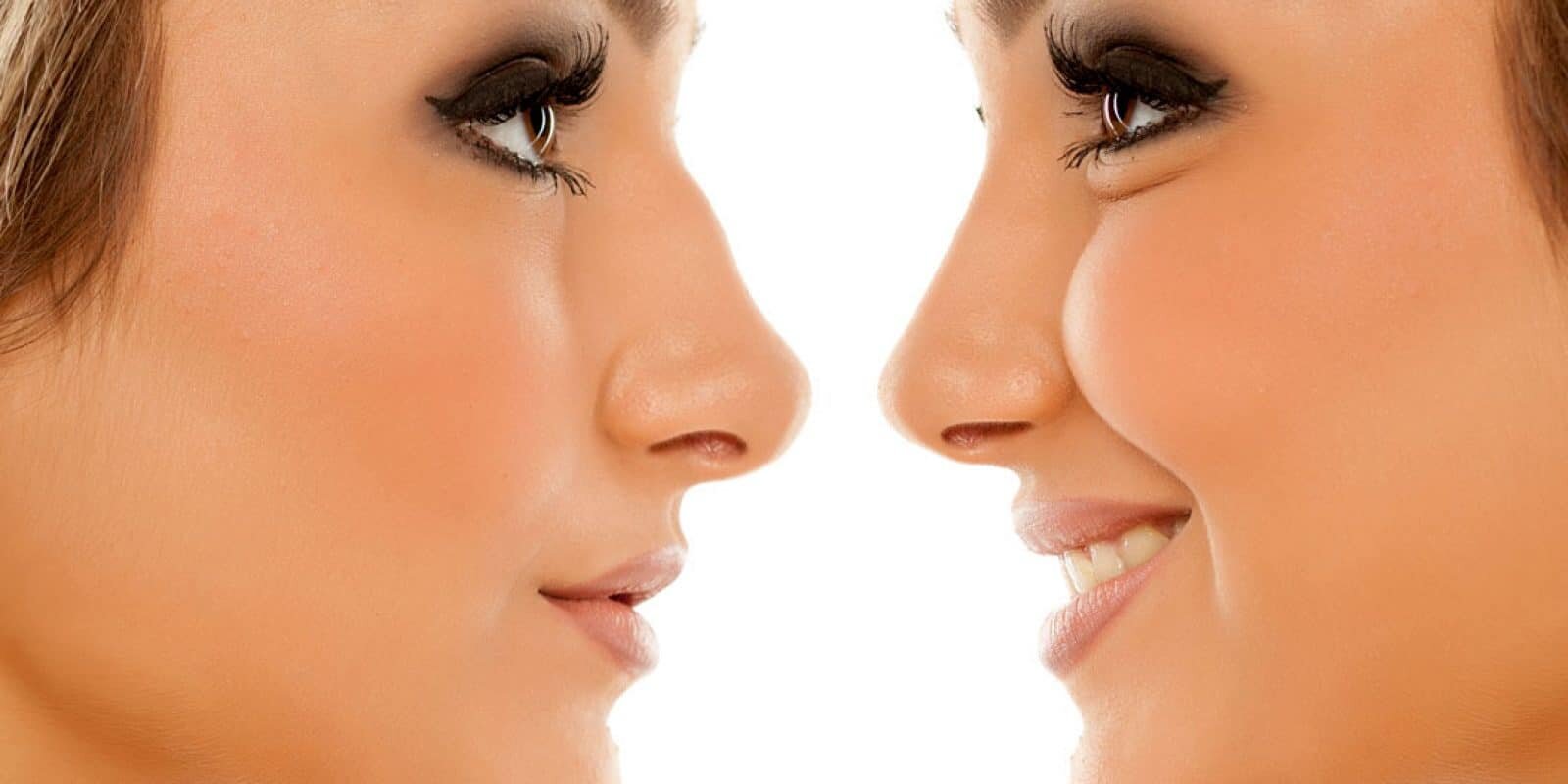 chirurgie-esthetique-rhinoplastie-tunisie-estetikatour