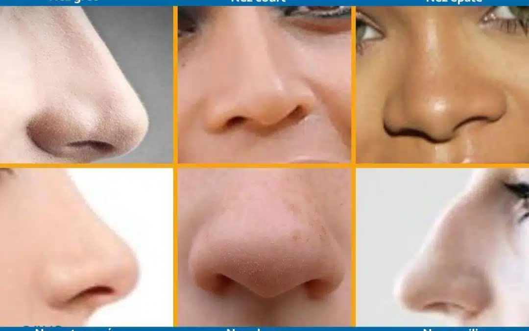 Types de nez chirurgie esthétique tunisie prix rhinoplastie, réduire taille de son nez