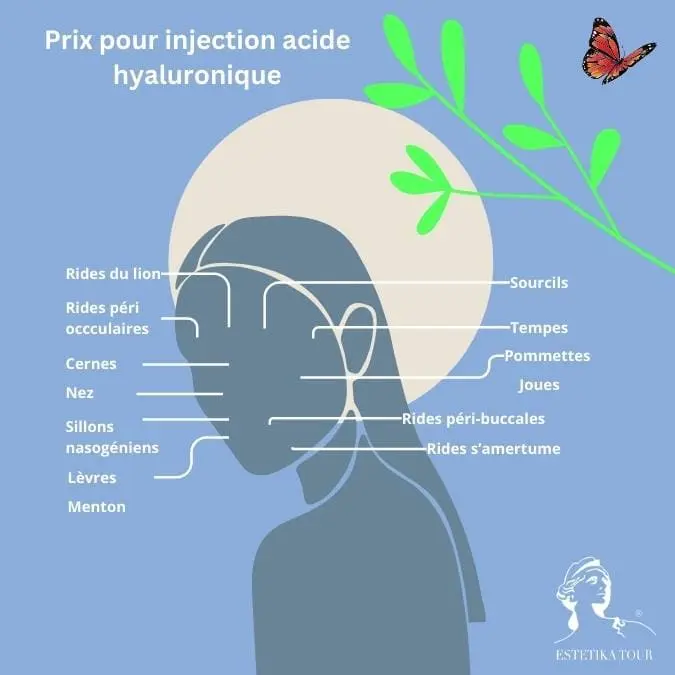 Prix pour injection acide hyaluronique