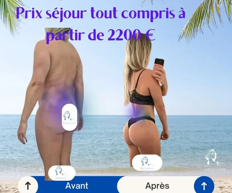 Liposuccion 360 prix, liposculpture tarif, Liposuccion complète